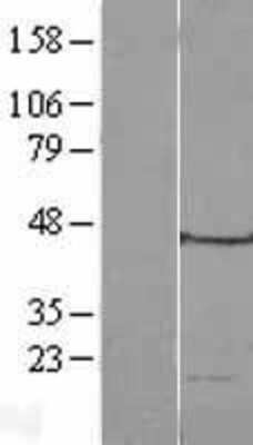 Western Blot: MRPL49 Overexpression Lysate [NBL1-13276]