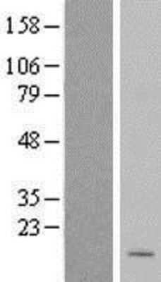 Western Blot: MRPL50 Overexpression Lysate [NBL1-13277]