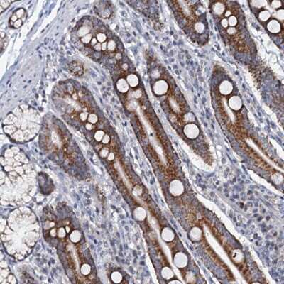 Immunohistochemistry-Paraffin: MRPL51 Antibody [NBP1-88567]