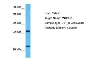 Western Blot: MRPL51 Antibody [NBP2-85323]