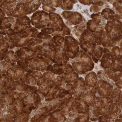 Immunohistochemistry-Paraffin: MRPL52 Antibody [NBP1-86094]