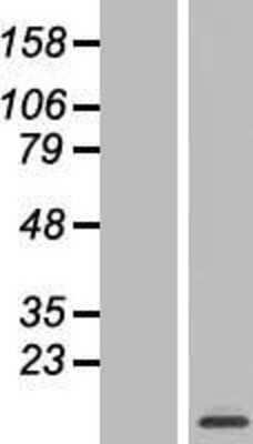 Western Blot: MRPL52 Overexpression Lysate [NBL1-13279]