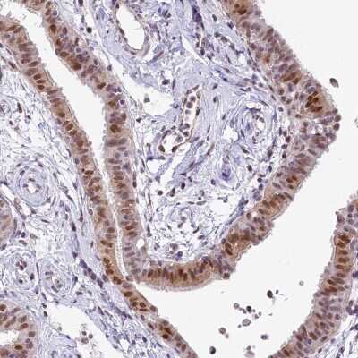 Immunohistochemistry-Paraffin: MRPL54 Antibody [NBP2-48761]