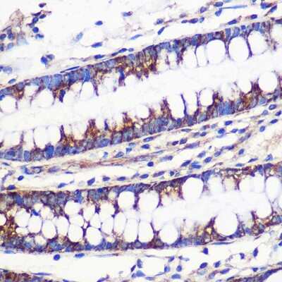 Immunohistochemistry-Paraffin: MRPL54 Antibody - Azide and BSA Free [NBP2-95150]