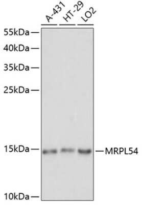 Western Blot: MRPL54 AntibodyAzide and BSA Free [NBP2-95150]