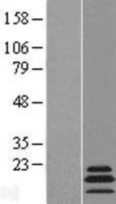 Western Blot: MRPL54 Overexpression Lysate [NBL1-13281]