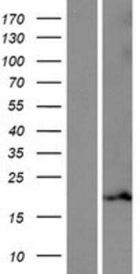 Western Blot: MRPL55 Overexpression Lysate [NBP2-04927]