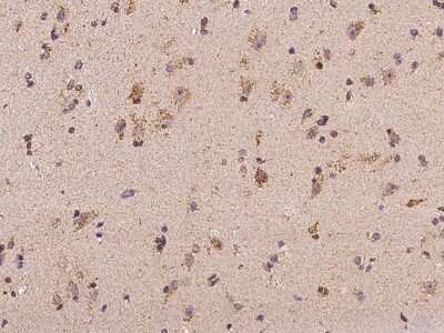 Immunohistochemistry: MRPL9 Antibody [NBP3-06270]
