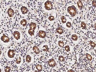 Immunohistochemistry-Paraffin: MRPL9 Antibody [NBP3-06270]