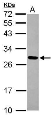 Western Blot: MRPL9 Antibody [NBP2-19408]