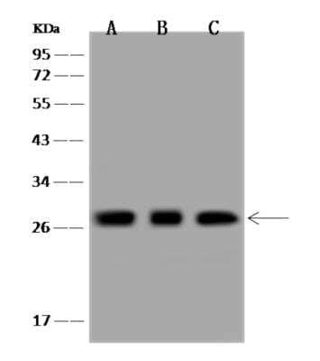 Western Blot: MRPL9 Antibody [NBP3-06270]