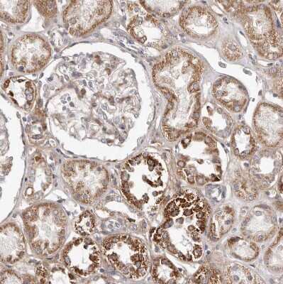 Immunohistochemistry-Paraffin: MRPS10 Antibody [NBP1-83847]