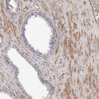 Immunohistochemistry-Paraffin: MRPS10 Antibody [NBP1-83847]