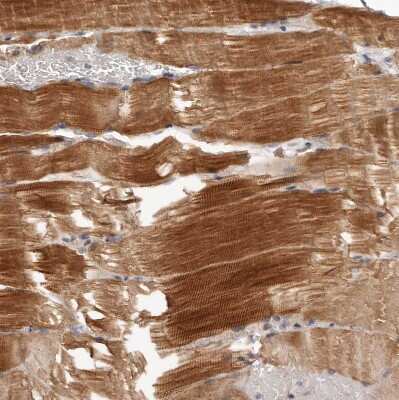 Immunohistochemistry-Paraffin: MRPS10 Antibody [NBP1-83847]