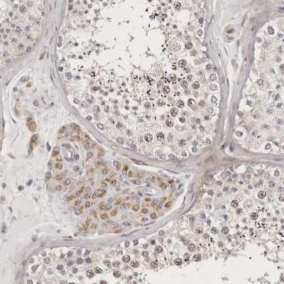 Immunohistochemistry-Paraffin: MRPS10 Antibody [NBP1-83847]