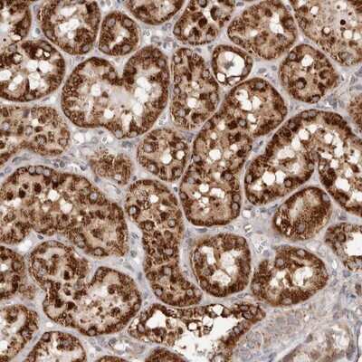 Immunohistochemistry-Paraffin: MRPS10 Antibody [NBP1-83848]