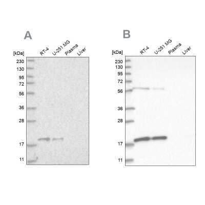 Western Blot: MRPS10 Antibody [NBP1-83847]