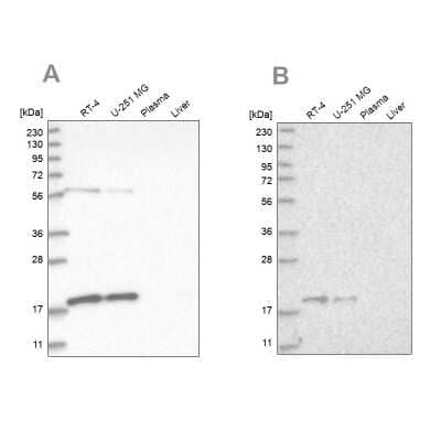 Western Blot: MRPS10 Antibody [NBP1-83848]