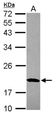 Western Blot: MRPS10 Antibody [NBP2-19409]