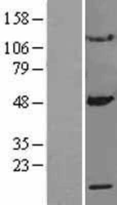 Western Blot: MRPS10 Overexpression Lysate [NBP2-04369]