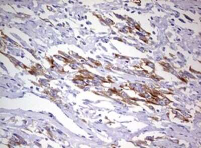 Immunohistochemistry: MRPS11 Antibody (OTI2E9) [NBP2-45937]