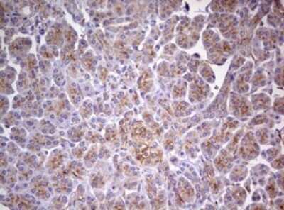 Immunohistochemistry: MRPS11 Antibody (OTI2E9) [NBP2-45937]