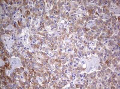 Immunohistochemistry: MRPS11 Antibody (OTI2E9) [NBP2-45937]