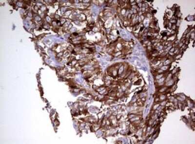 Immunohistochemistry: MRPS11 Antibody (OTI2E9) [NBP2-45937]