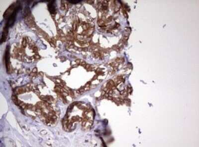 Immunohistochemistry: MRPS11 Antibody (OTI2E9) [NBP2-45937]