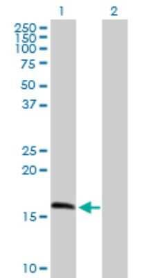 Western Blot: MRPS11 Antibody [H00064963-B02P]