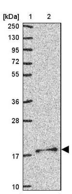 Western Blot: MRPS11 Antibody [NBP2-30823]