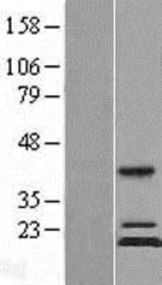 Western Blot: MRPS11 Overexpression Lysate [NBL1-13284]