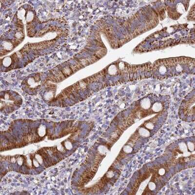 Immunohistochemistry-Paraffin: MRPS12 Antibody [NBP2-13620]