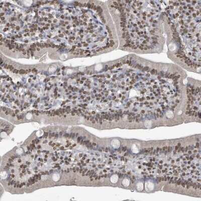 Immunohistochemistry-Paraffin: MRPS12 Antibody [NBP2-13621]