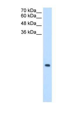 Western Blot: MRPS12 Antibody [NBP1-54647]