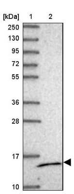 Western Blot: MRPS14 Antibody [NBP2-13622]