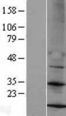 Western Blot: MRPS14 Overexpression Lysate [NBL1-13286]