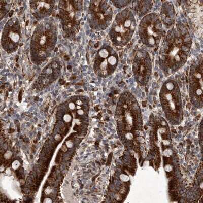 Immunohistochemistry-Paraffin: MRPS15 Antibody [NBP1-82319]
