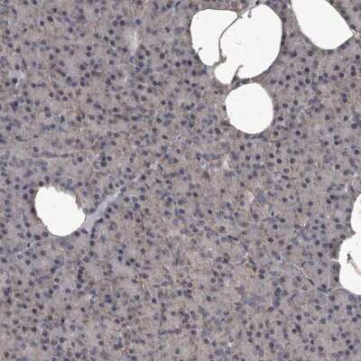 Immunohistochemistry-Paraffin: MRPS15 Antibody [NBP1-82319]