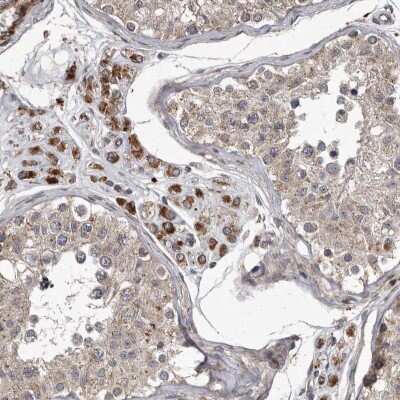Immunohistochemistry-Paraffin: MRPS15 Antibody [NBP1-82319]