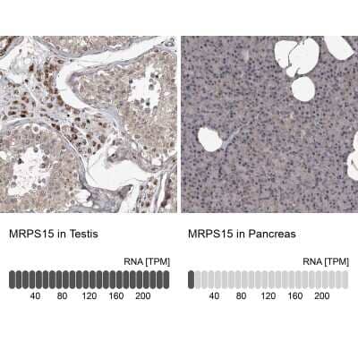 Immunohistochemistry-Paraffin: MRPS15 Antibody [NBP1-82319]