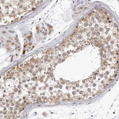 Immunohistochemistry-Paraffin: MRPS15 Antibody [NBP1-87400]