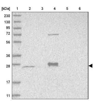 Western Blot: MRPS15 Antibody [NBP1-82319]