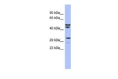 Western Blot: MRPS15 Antibody [NBP2-87831]