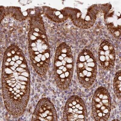 Immunohistochemistry-Paraffin: MRPS16 Antibody [NBP2-33587]