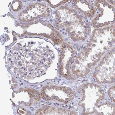 Immunohistochemistry-Paraffin: MRPS16 Antibody [NBP2-33721]