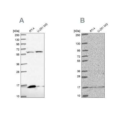 Western Blot: MRPS16 Antibody [NBP2-33587]