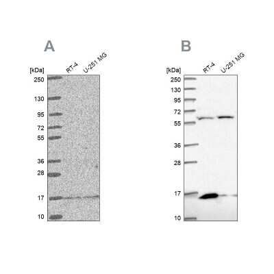 Western Blot: MRPS16 Antibody [NBP2-33721]