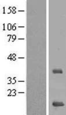 Western Blot: MRPS16 Overexpression Lysate [NBL1-13288]