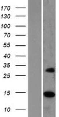 Western Blot: MRPS17 Overexpression Lysate [NBP2-07102]